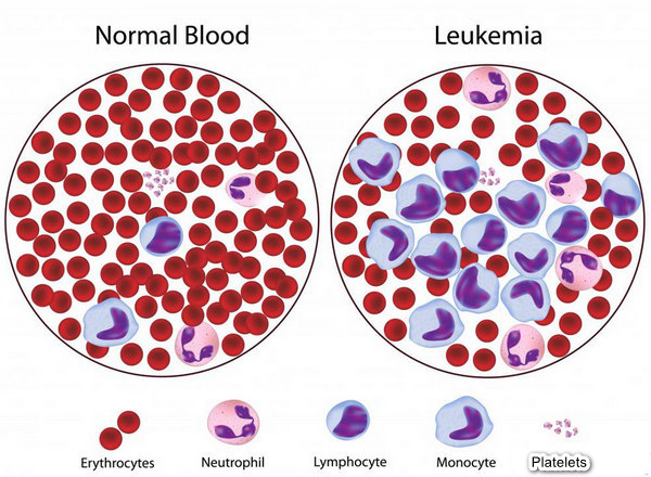 mvp, blood test, thử máu, tiểu cầu