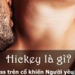 hickey là gì