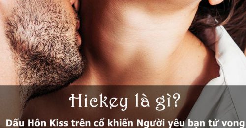 hickey là gì