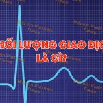 Khối lượng Giao dịch (Volume) là gì?