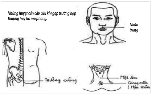 Thượng mã phong - Trạng thái nguy hiểm khi “yêu”