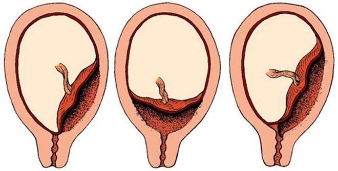 Placenta là gì? Có tốt cho da hay không?