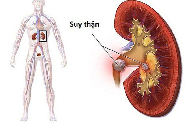 Á Thần Là Gì - Điểm Mặt 5 Vị Anh Hùng Trong Thần Thoại Hy Lạp