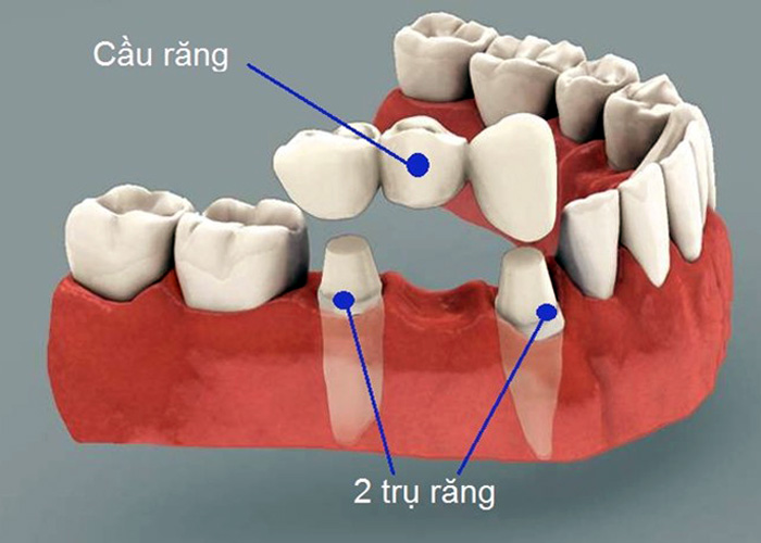 Dàn diễn viên trong phim (Ảnh: Internet)
